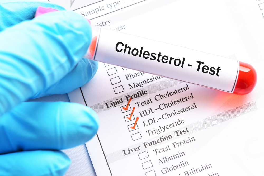cholesterol management - blog post - southport doctors
