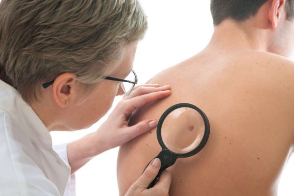 Skin Cancer Clinic Southport - Blog Post - Skin Cancer Checks